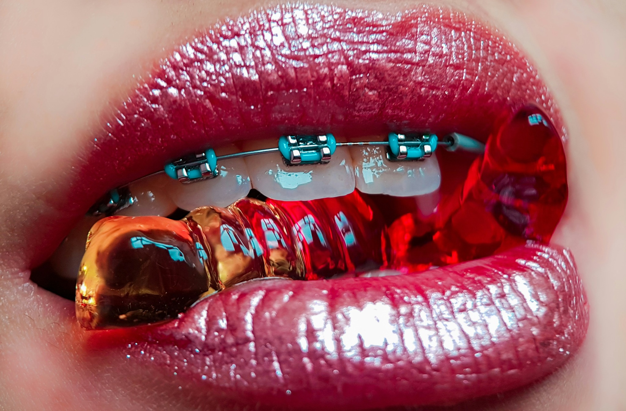 A close-up of pink lips, braces, and colorful gummy candy